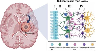 The Subventricular Zone in Glioblastoma: Genesis, Maintenance, and Modeling